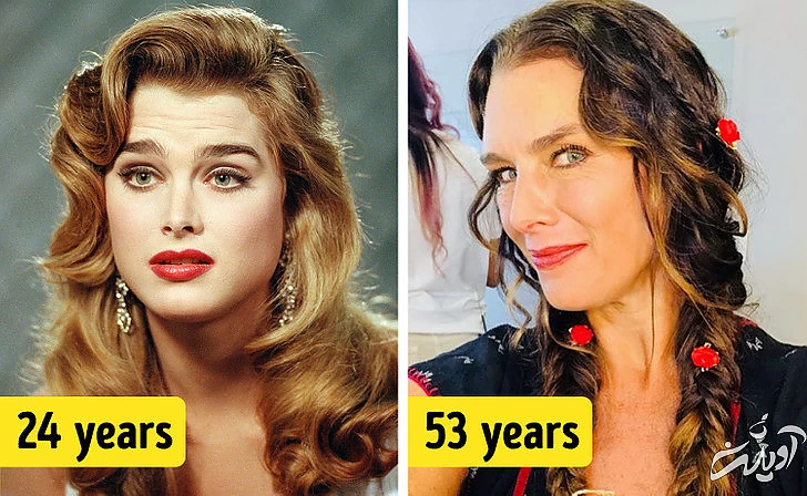 چهره‌های معروفی که هیچ جراحی زیبایی نکرده‌اند